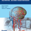 Video Atlas of Acute Ischemic Stroke Intervention 1st Edition