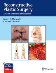 Reconstructive Plastic Surgery: An Atlas of Essential Procedures 1st Edition PDF & video