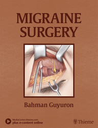 Migraine Surgery 1st Edition PDF Original & Video