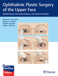 Ophthalmic Plastic Surgery of the Upper Face: Eyelid Ptosis, Dermatochalasis, and Eyebrow Ptosis 1st Edition PDF & VIDEO