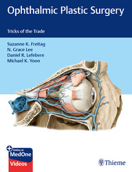 Ophthalmic Plastic Surgery: Tricks of the Trade 1st Edition PD