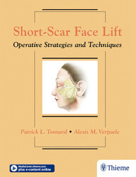 Short-Scar Face Lift: Operative Strategies and Techniques 1st Edition PDF & Video