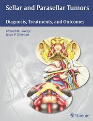 Sellar and Parasellar Tumors: Diagnosis, Treatments, and Outcomes 1st Edition PDF