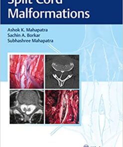 Split Cord Malformations PDF