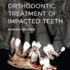 Orthodontic Treatment of Impacted Teeth 4th Edition PDF