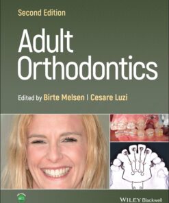 Adult Orthodontics 2nd Edition PDF