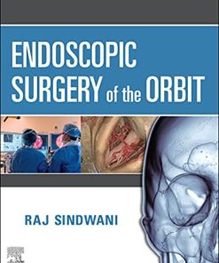 Endoscopic Surgery of the Orbit 1st Edition PDF & VIDEO