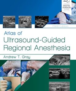 Atlas of Ultrasound-Guided Regional Anesthesia: Expert Consult - Online and Print 3rd Edition PDF Original & Video