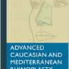 Advanced Caucasian and Mediterranean Rhinoplasty 1st Edition