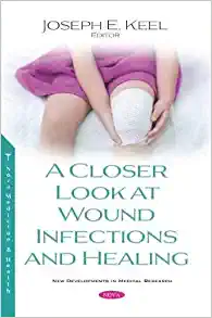 A Closer Look at Wound Infections and Healing (New Developments in Medical Research) (Original PDF from Publisher)