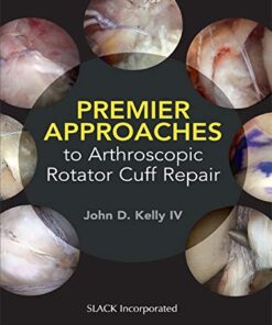 Premier Approaches to Arthroscopic Rotator Cuff Repair (Original PDF from Publisher)