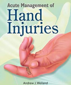 Acute Management of Hand Injuries (Original PDF from Publisher)