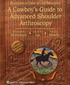 Burkhart’s View of the Shoulder: A Cowboy’s Guide to Advanced Shoulder Arthroscopy (Original PDF from Publisher)