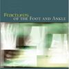 Fractures of the Foot and Ankle (Original PDF From Publisher)