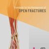 Standards for the Management of Open Fractures (Original PDF from Publisher)