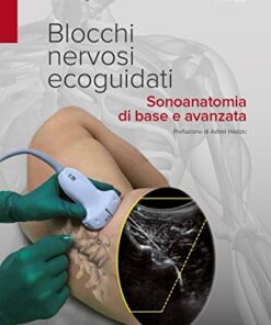 Blocchi nervosi ecoguidati. Sonoanatomia di base avanzata (EPUB)