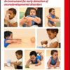 SINDA Standardized Infant NeuroDevelopmental Assessment: An Instrument for Early Detection of Neurodevelopmental Disorders (Mac Keith Press Practical Guides) (Original PDF from Publisher)