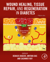 Wound Healing, Tissue Repair, and Regeneration in Diabetes