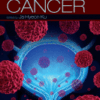 Bladder Cancer