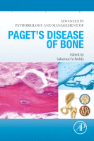 Advances in Pathobiology and Management of Paget's Disease of Bone