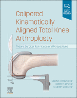 Calipered Kinematically Aligned Total Knee Arthroplasty Theory, Surgical Techniques and Perspectives