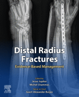 Distal Radius Fractures Evidence-Based Management