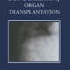 Bone Disease of Organ Transplantation