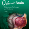 Osborn's Brain