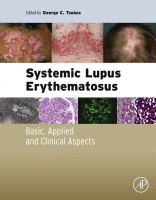 Systemic Lupus Erythematosus Basic, Applied and Clinical Aspects