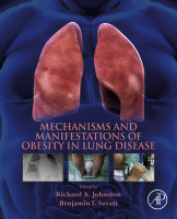 Mechanisms and Manifestations of Obesity in Lung Disease