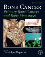 Bone Cancer Primary Bone Cancers and Bone Metastases