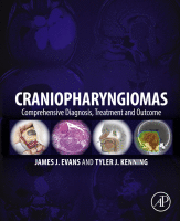 Craniopharyngiomas Comprehensive Diagnosis, Treatment and Outcome