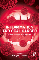 Inflammation and Oral Cancer From Bench to Bedside