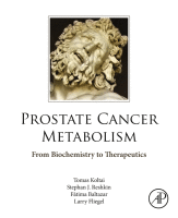 Prostate Cancer Metabolism From Biochemistry to Therapeutics