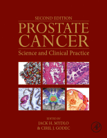 Prostate Cancer Science and Clinical Practice