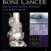 Bone Sarcomas and Bone Metastases - From Bench to Bedside Bone Sarcomas and Bone Metastases - from Bench to Bedside