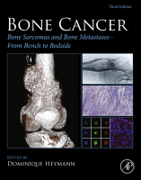 Bone Sarcomas and Bone Metastases - From Bench to Bedside Bone Sarcomas and Bone Metastases - from Bench to Bedside