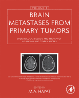 Brain Metastases from Primary Tumors, Volume 3 Epidemiology, Biology, and Therapy of Melanoma and Other Cancers