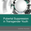 Pubertal Suppression in Transgender Youth