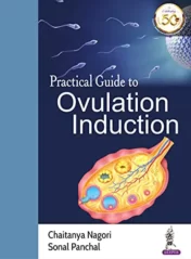 Practical Guide to Ovulation Induction