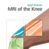 MRI of the Knee