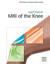 MRI of the Knee