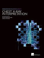 Discover Radiology: Chest X-Ray Interpretation 1st Ed