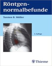 Röntgennormalbefunde BY Möller 2003 Original Pdf