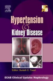 Hypertension and Kidney Disease - ECAB