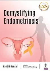 Demystifying Endometriosis