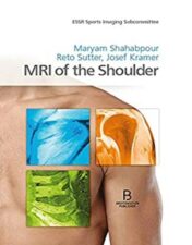 MRI of the Shoulder