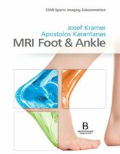 MRI Foot&Ankle