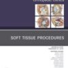 Soft Tissue Procedures, An Issue of Orthopedic Clinics