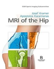 MRI of the Hip